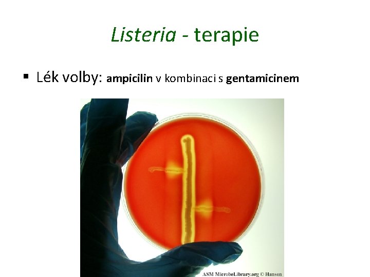 Listeria - terapie § Lék volby: ampicilin v kombinaci s gentamicinem 