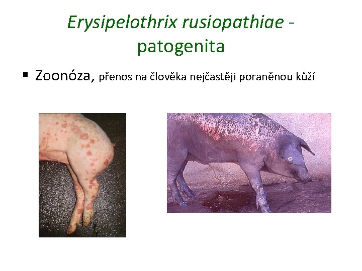 Erysipelothrix rusiopathiae patogenita § Zoonóza, přenos na člověka nejčastěji poraněnou kůží 