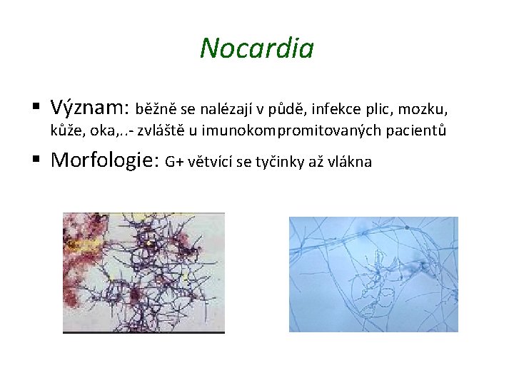 Nocardia § Význam: běžně se nalézají v půdě, infekce plic, mozku, kůže, oka, .