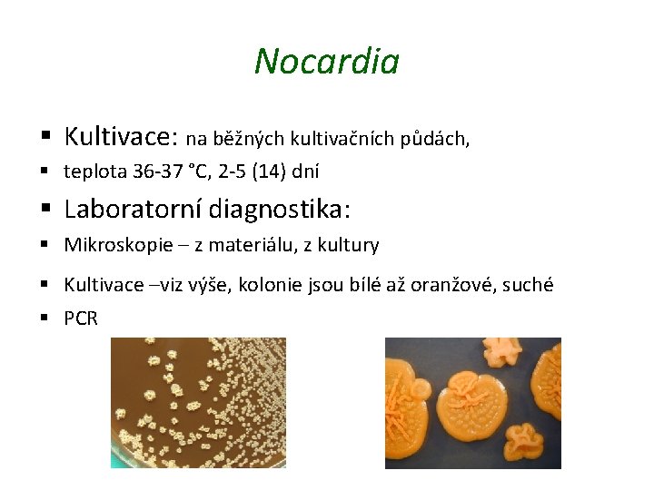 Nocardia § Kultivace: na běžných kultivačních půdách, § teplota 36 -37 °C, 2 -5