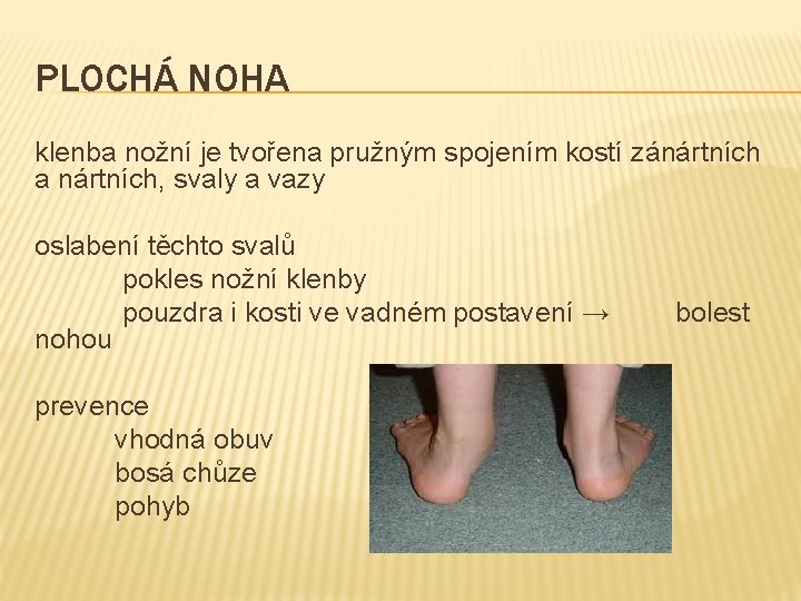 PLOCHÁ NOHA klenba nožní je tvořena pružným spojením kostí zánártních a nártních, svaly a