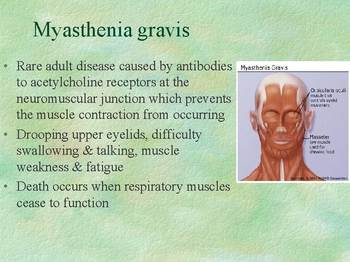 Myasthenia gravis • Rare adult disease caused by antibodies to acetylcholine receptors at the