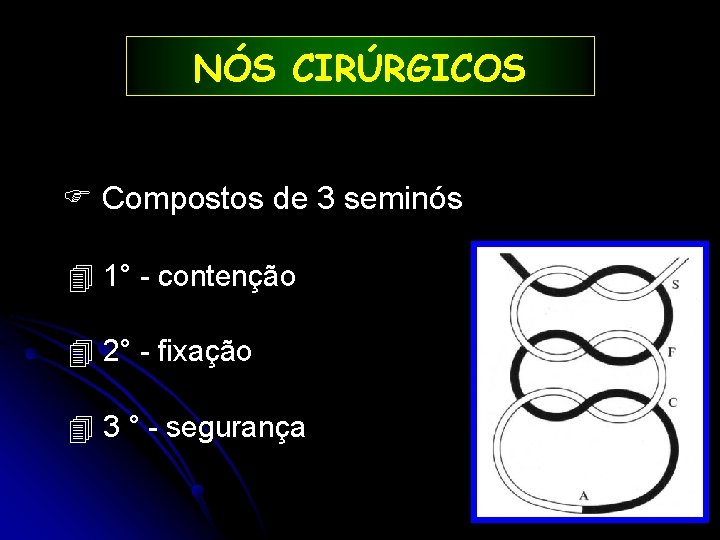 NÓS CIRÚRGICOS Compostos de 3 seminós 4 1° - contenção 4 2° - fixação