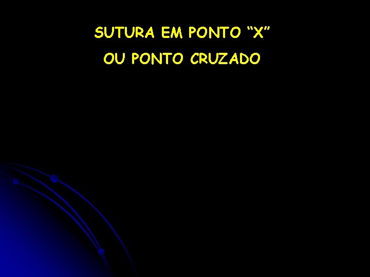 SUTURA EM PONTO “X” OU PONTO CRUZADO 