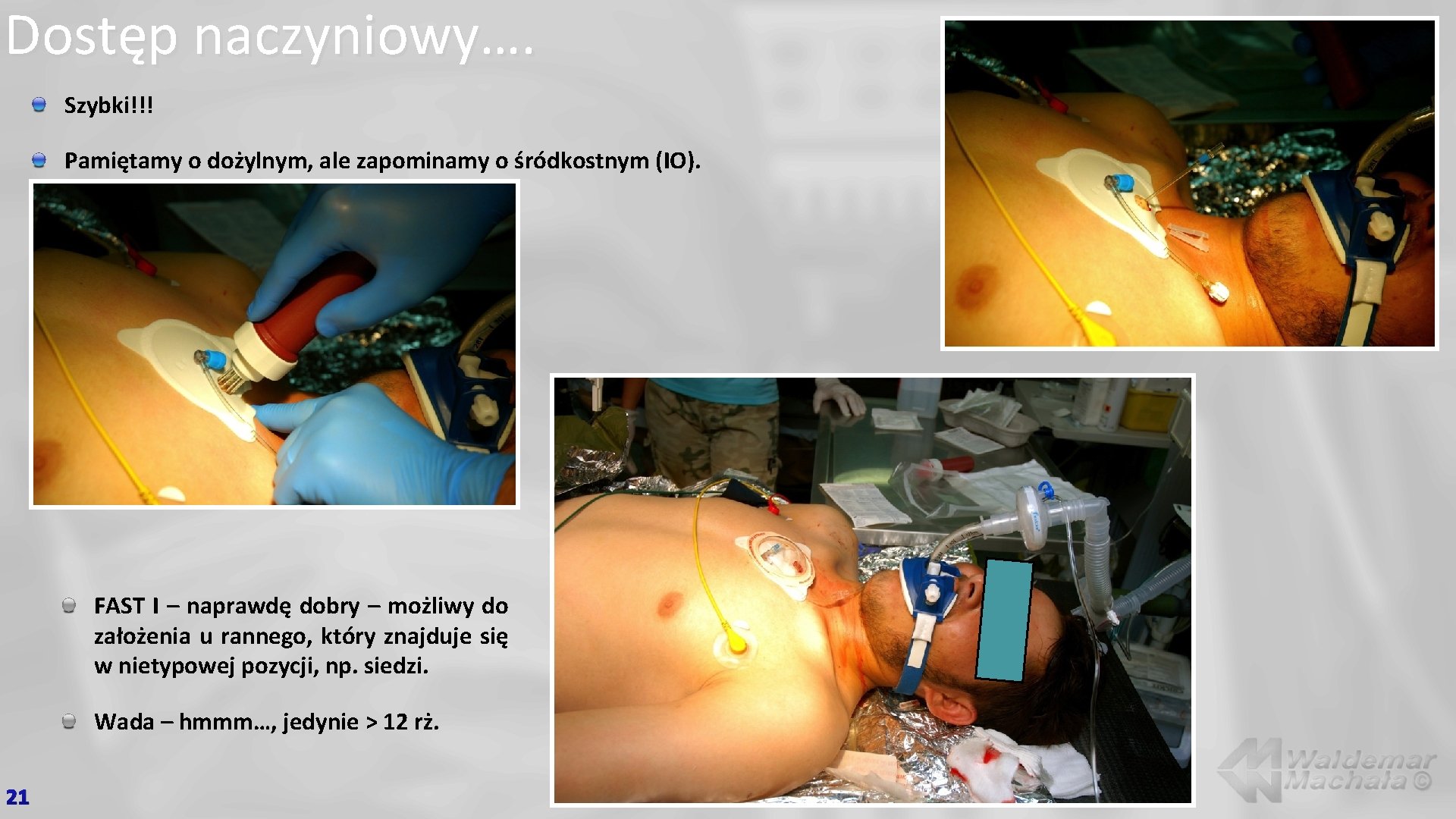 Dostęp naczyniowy…. Szybki!!! Pamiętamy o dożylnym, ale zapominamy o śródkostnym (IO). FAST I –