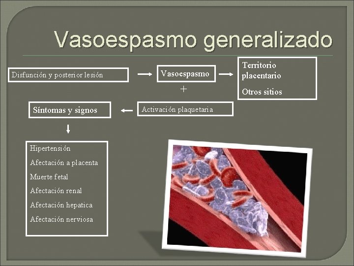 Vasoespasmo generalizado Disfunción y posterior lesión Síntomas y signos Hipertensión Afectación a placenta Muerte