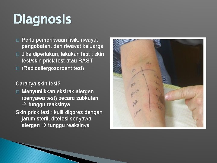 Diagnosis � � � Perlu pemeriksaan fisik, riwayat pengobatan, dan riwayat keluarga Jika diperlukan,