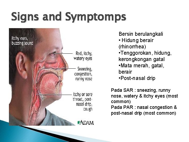 Signs and Symptomps Bersin berulangkali • Hidung berair (rhinorrhea) • Tenggorokan, hidung, kerongkongan gatal