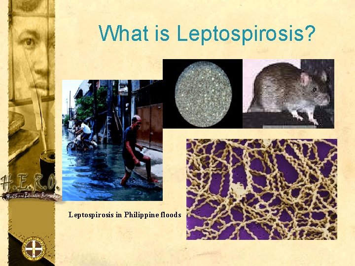 What is Leptospirosis? Leptospirosis in Philippine floods 