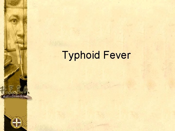 Typhoid Fever 