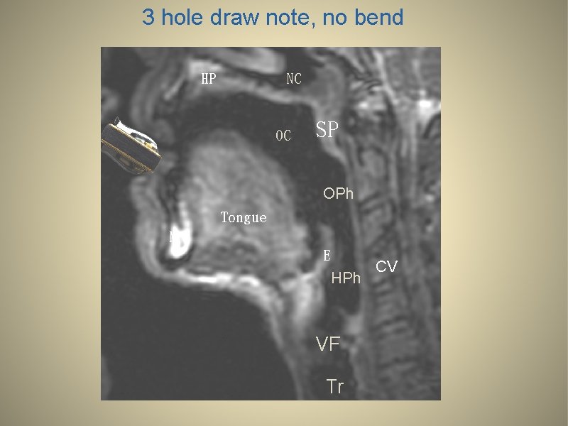 3 hole draw note, no bend HP NC OC SP OPh Tongue M E