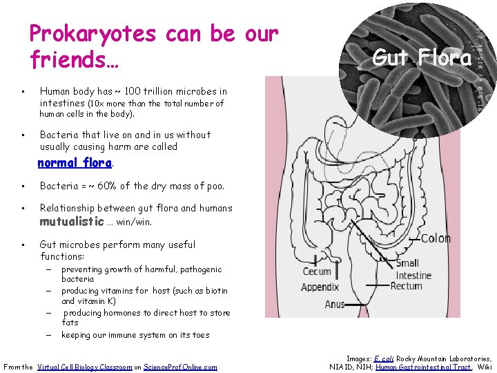 Prokaryotes can be our friends… • Gut Flora Human body has ~ 100 trillion