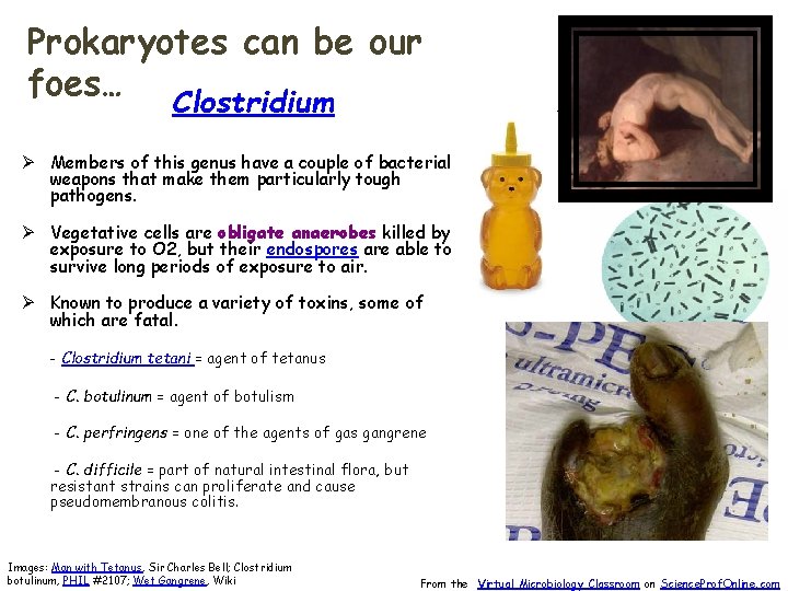 Prokaryotes can be our foes… Clostridium Ø Members of this genus have a couple