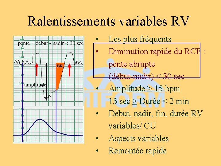 Ralentissements variables RV • • • Les plus fréquents Diminution rapide du RCF :