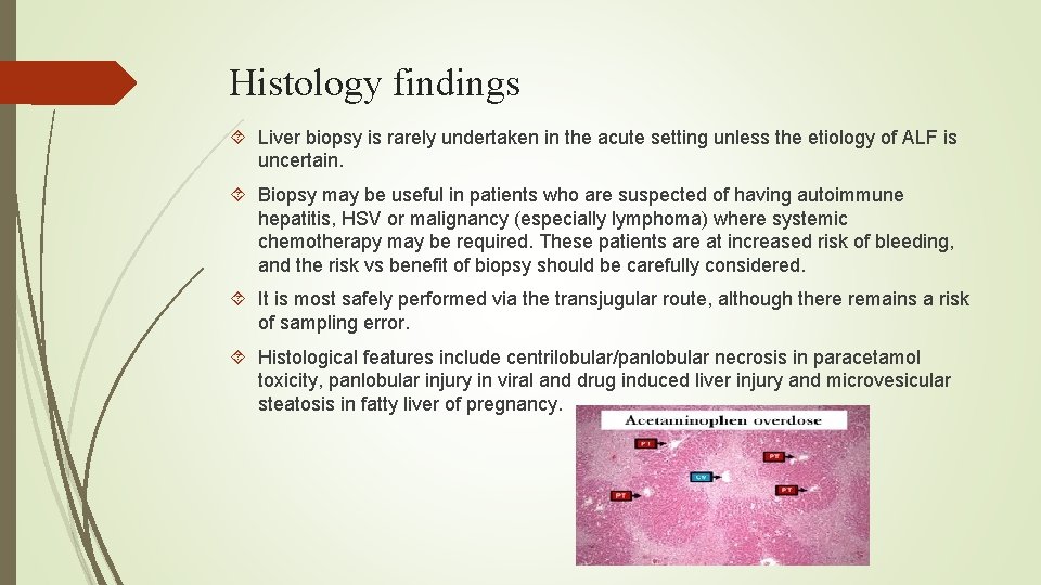 Histology findings Liver biopsy is rarely undertaken in the acute setting unless the etiology
