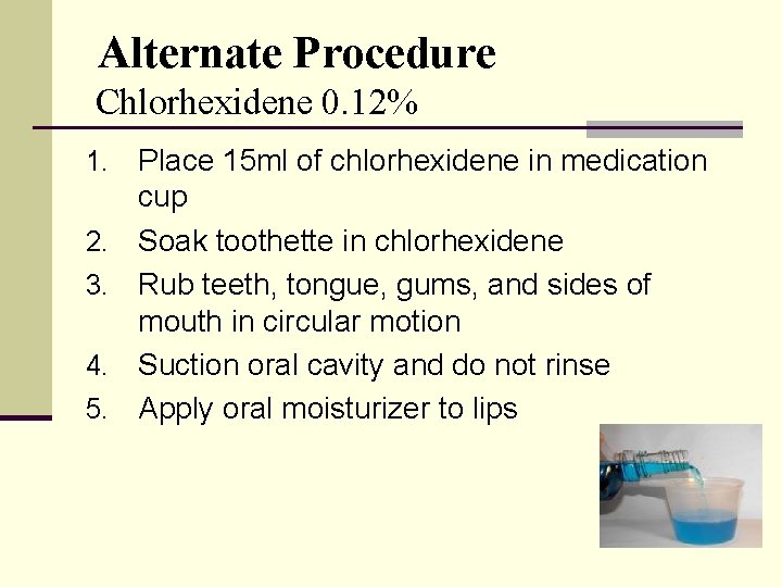 Alternate Procedure Chlorhexidene 0. 12% 1. 2. 3. 4. 5. Place 15 ml of
