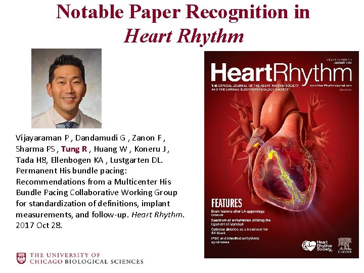 Notable Paper Recognition in Heart Rhythm Vijayaraman P , Dandamudi G , Zanon F