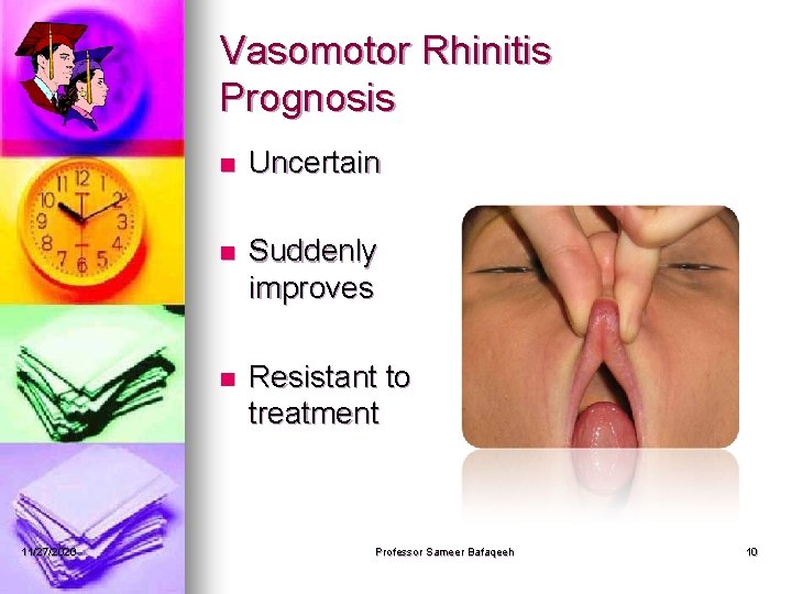 Vasomotor Rhinitis Prognosis 11/27/2020 n Uncertain n Suddenly improves n Resistant to treatment Professor