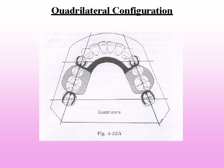 Quadrilateral Configuration Quadrilateral Configuration