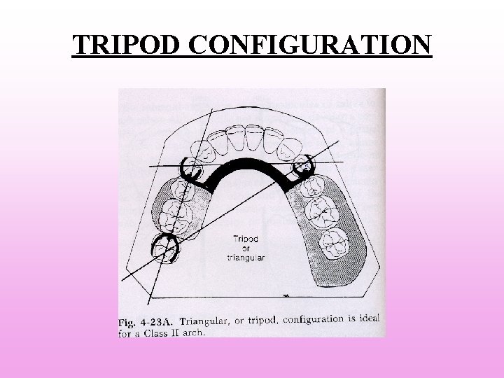 TRIPOD CONFIGURATION TRIPOD CONFIGURATION