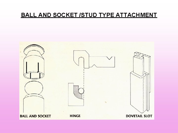BALL AND SOCKET /STUD TYPE ATTACHMENT BALL AND SOCKET /STUD TYPE ATTACHMENT