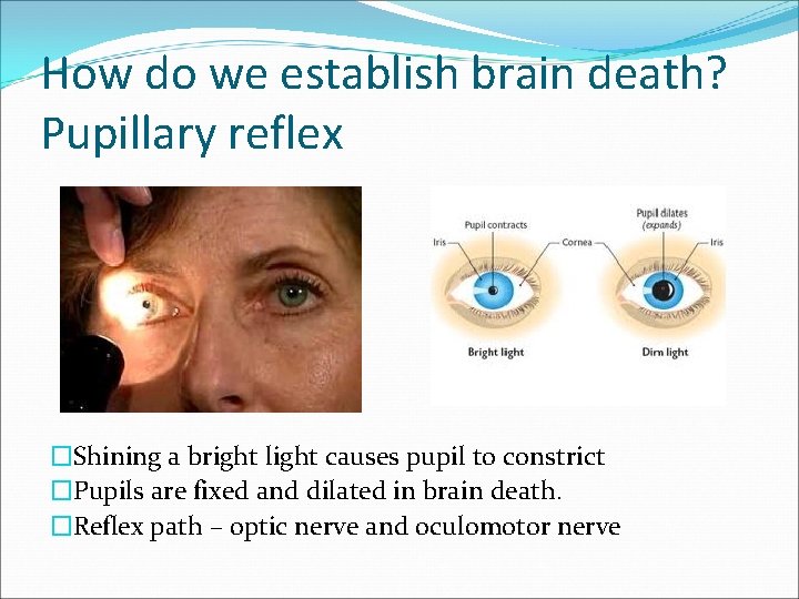 How do we establish brain death? Pupillary reflex �Shining a bright light causes pupil