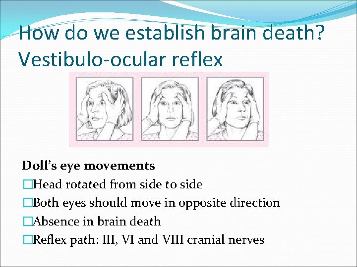 How do we establish brain death? Vestibulo-ocular reflex Doll’s eye movements �Head rotated from