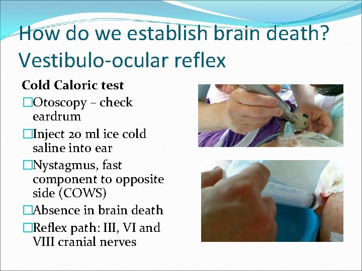 How do we establish brain death? Vestibulo-ocular reflex Cold Caloric test �Otoscopy – check