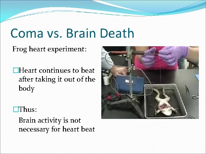 Coma vs. Brain Death Frog heart experiment: �Heart continues to beat after taking it