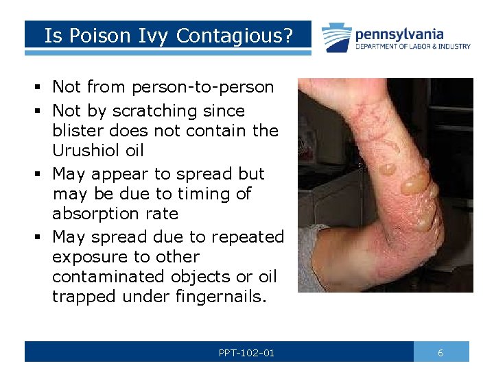 Poison Ivy Awareness Bureau of Workers Compensation PA