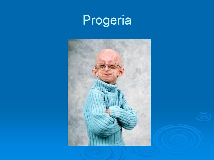 Progeria 