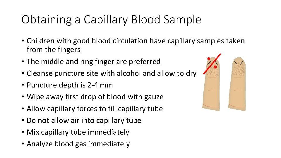 Obtaining a Capillary Blood Sample • Children with good blood circulation have capillary samples