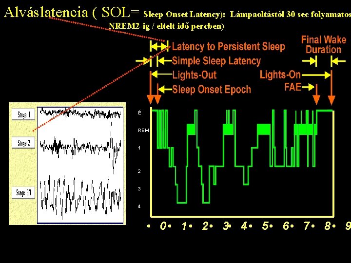 Alváslatencia ( SOL= Sleep Onset Latency): Lámpaoltástól 30 sec folyamatos NREM 2 -ig /