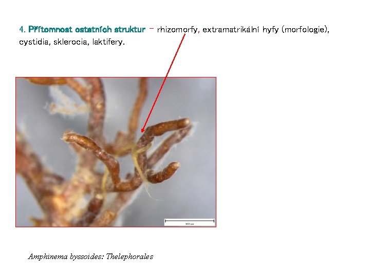 4. Přítomnost ostatních struktur – rhizomorfy, extramatrikální hyfy (morfologie), cystidia, sklerocia, laktifery. Amphinema byssoides: