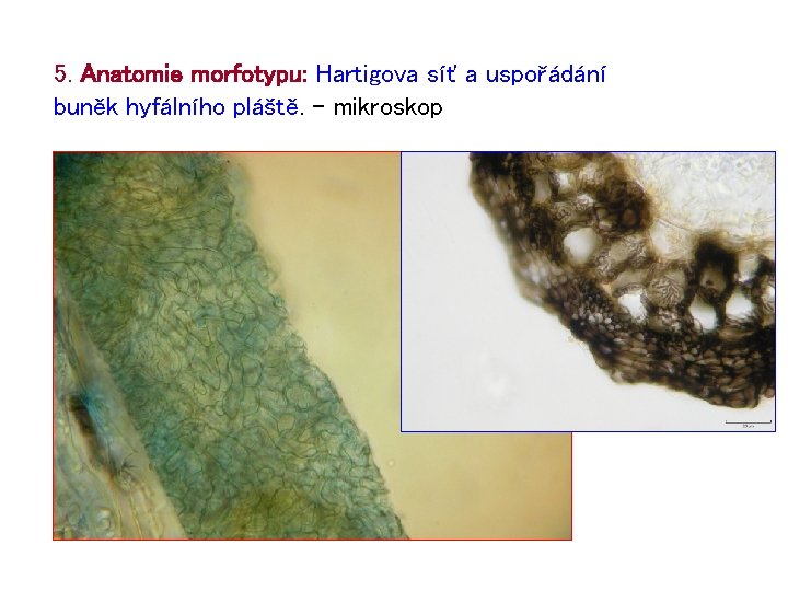 5. Anatomie morfotypu: Hartigova síť a uspořádání buněk hyfálního pláště. – mikroskop 