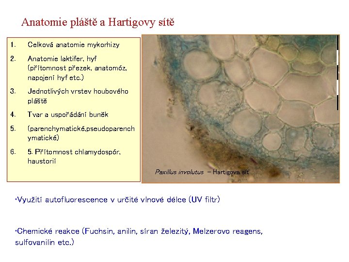 Anatomie pláště a Hartigovy sítě 1. Celková anatomie mykorhizy 2. Anatomie laktifer, hyf (přítomnost