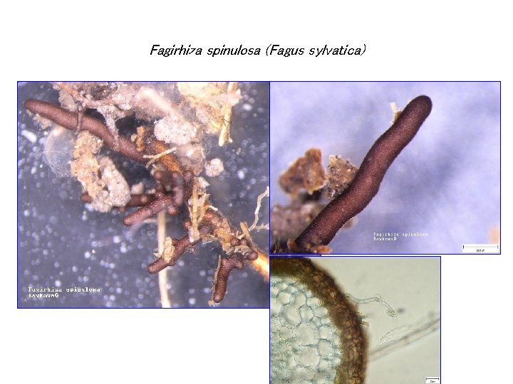 Fagirhiza spinulosa (Fagus sylvatica) 