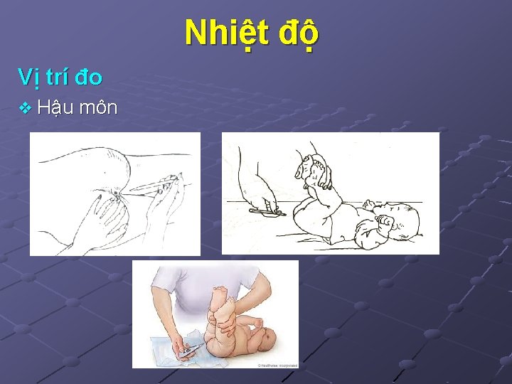 Nhiệt độ Vị trí đo v Hậu môn 