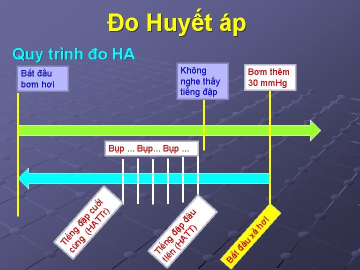 Đo Huyết áp Quy trình đo HA Không nghe thấy tiếng đập Bắt đầu