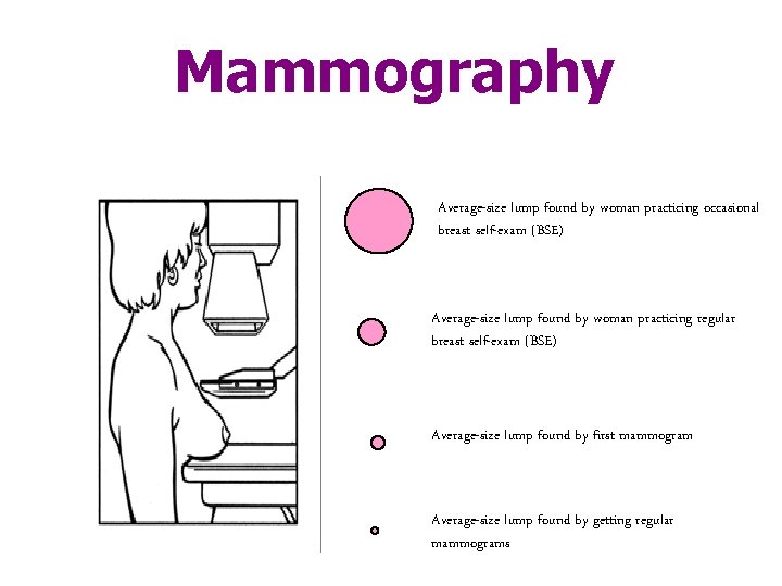 Mammography Average-size lump found by woman practicing occasional breast self-exam (BSE) Average-size lump found