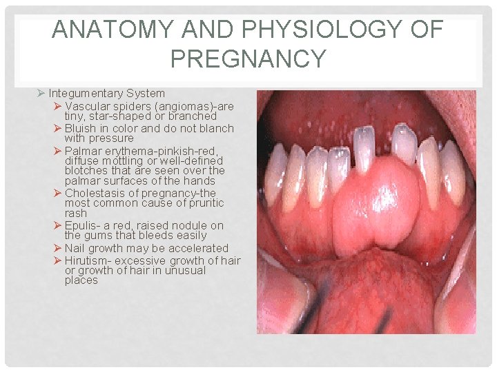 ANATOMY AND PHYSIOLOGY OF PREGNANCY Ø Integumentary System Ø Vascular spiders (angiomas)-are tiny, star-shaped