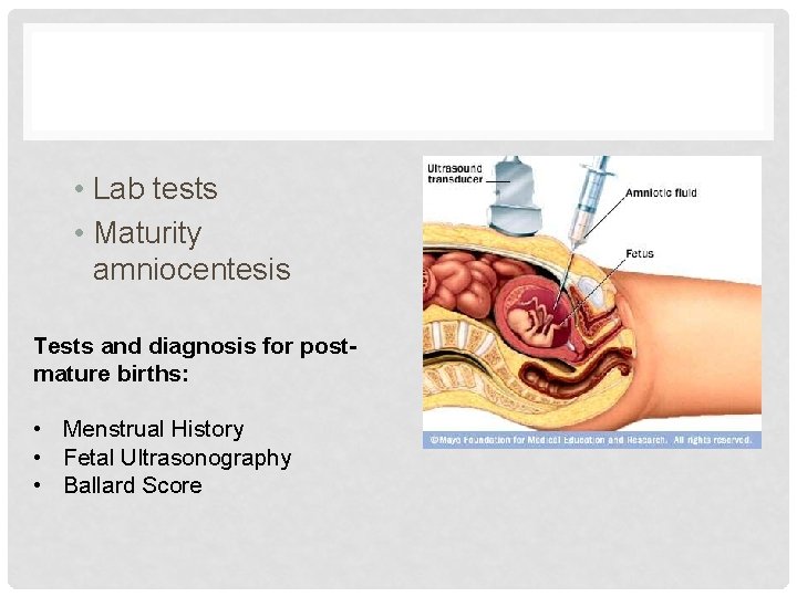  • Lab tests • Maturity amniocentesis Tests and diagnosis for postmature births: •