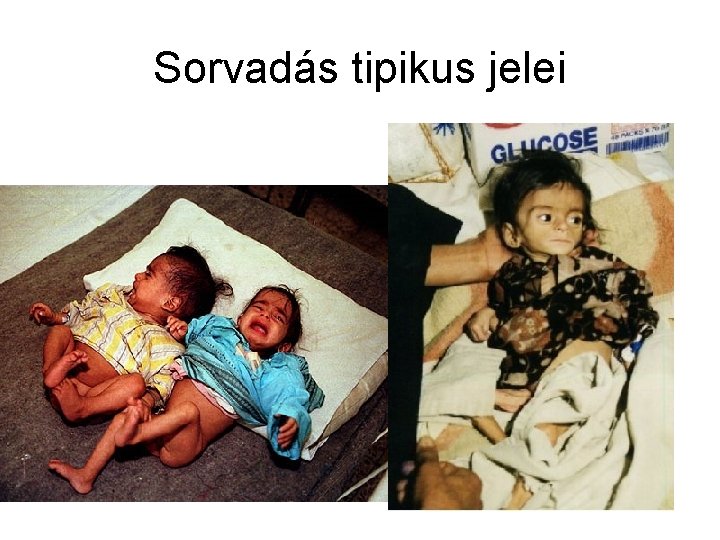 Sorvadás tipikus jelei 