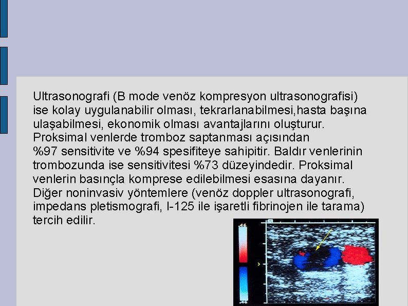 Ultrasonografi (B mode venöz kompresyon ultrasonografisi) ise kolay uygulanabilir olması, tekrarlanabilmesi, hasta başına ulaşabilmesi,