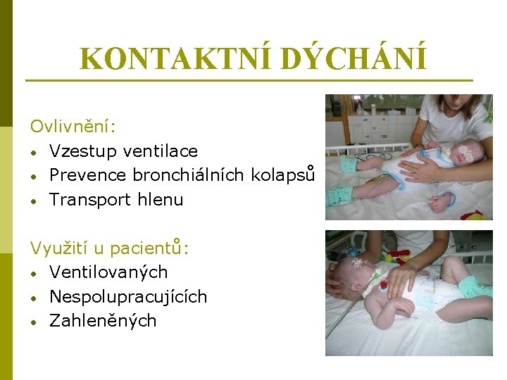 KONTAKTNÍ DÝCHÁNÍ Ovlivnění: • Vzestup ventilace • Prevence bronchiálních kolapsů • Transport hlenu Využití