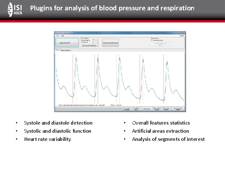 Plugins for analysis of blood pressure and respiration • • • Systole and diastole
