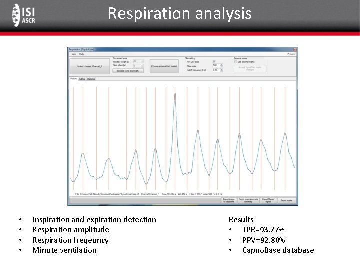 Respiration analysis • • Inspiration and expiration detection Respiration amplitude Respiration freqeuncy Minute ventilation