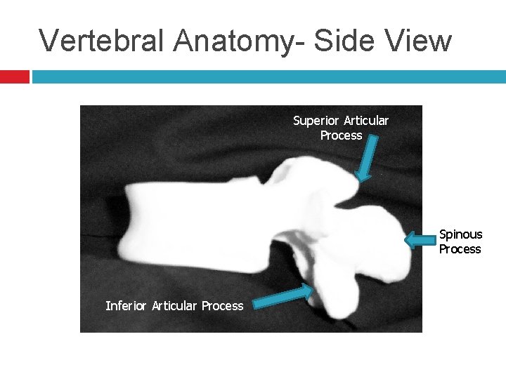 Vertebral Anatomy- Side View Superior Articular Process Spinous Process Inferior Articular Process 