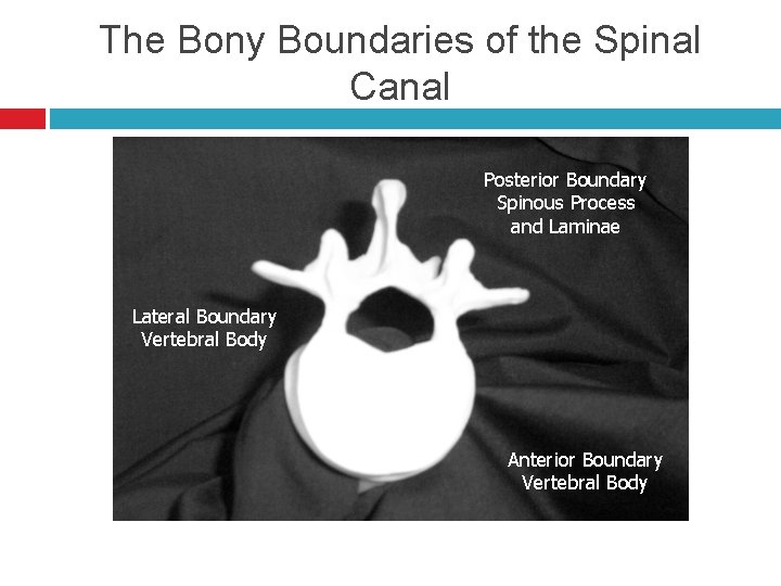 The Bony Boundaries of the Spinal Canal Posterior Boundary Spinous Process and Laminae Lateral
