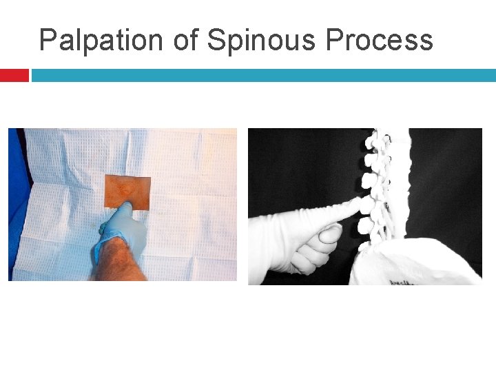 Palpation of Spinous Process 